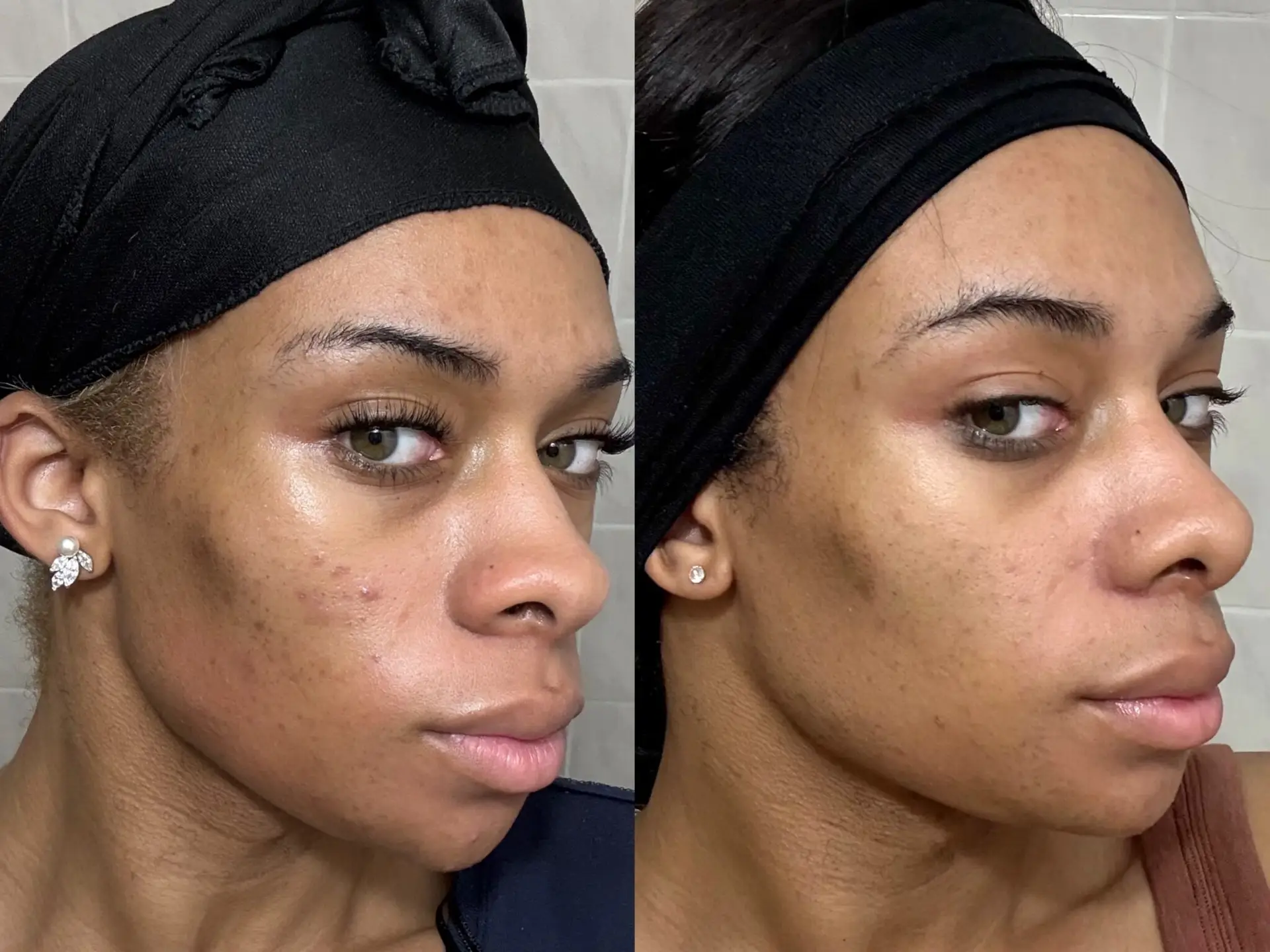 Before and After8