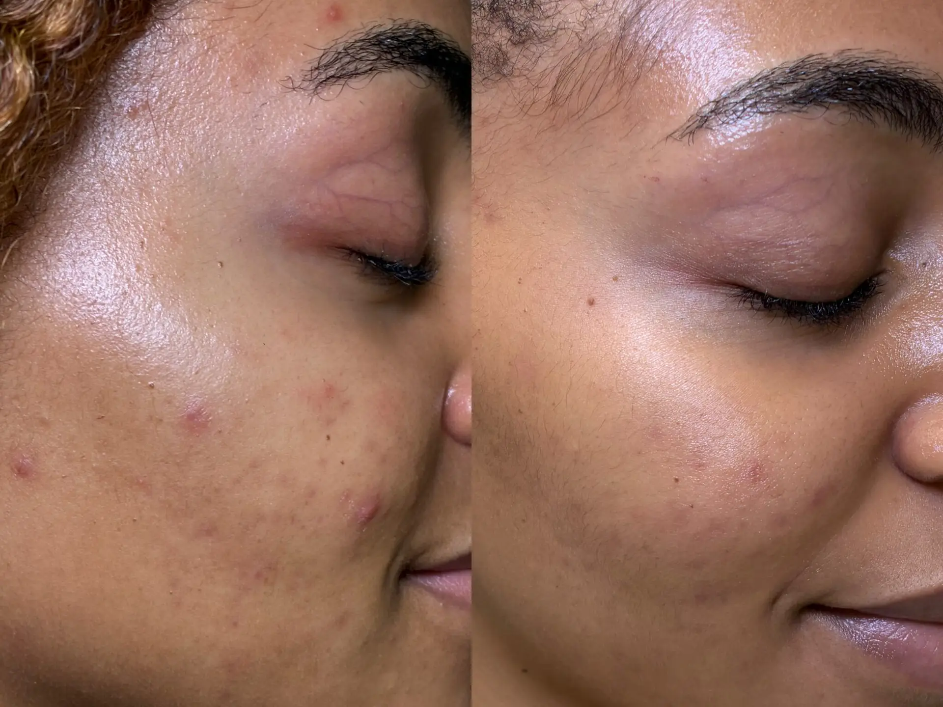 Before and After9