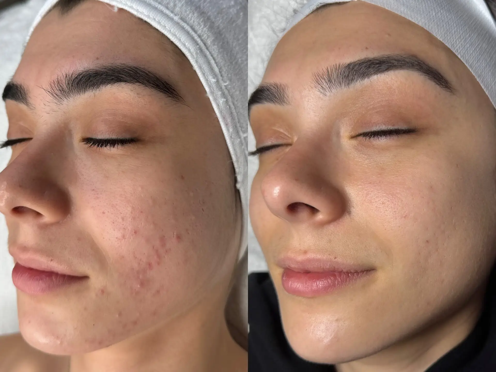 Before and After10
