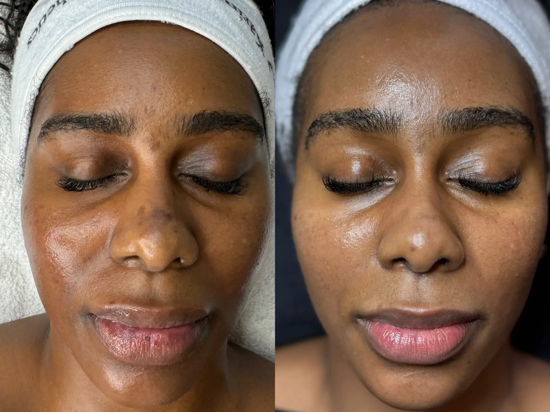 Before and After12