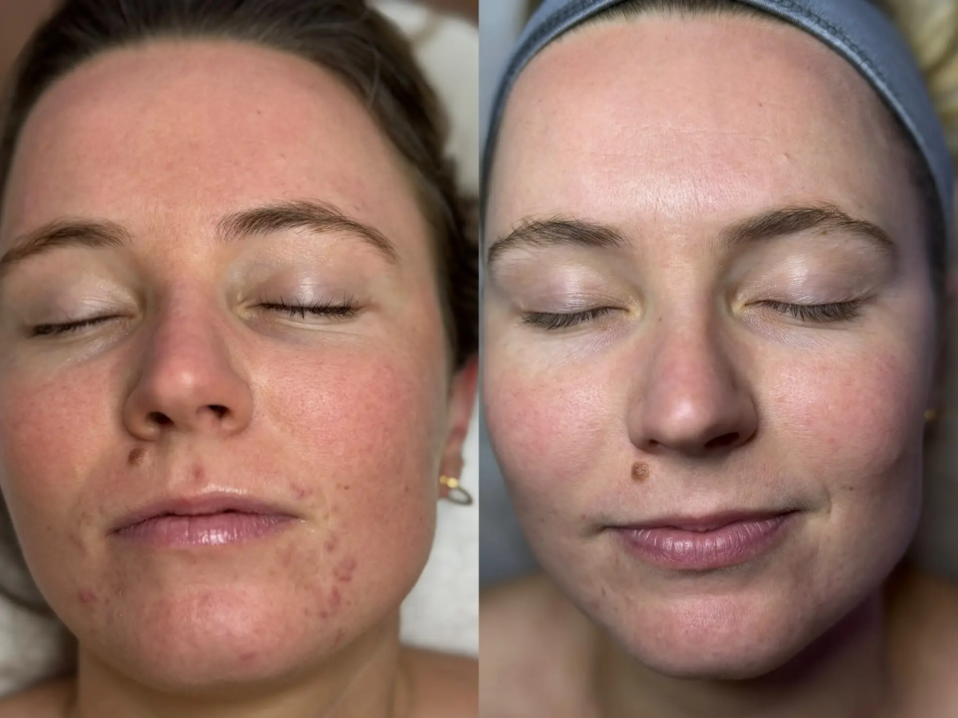 Before and After13